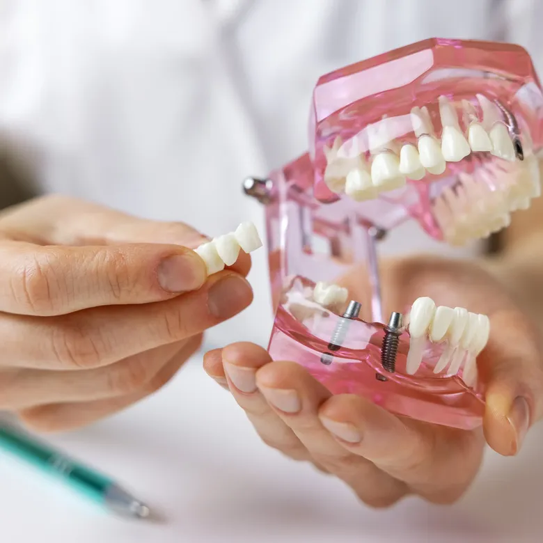 Die Zahnärzte am Mittelweg 150 in Hamburg